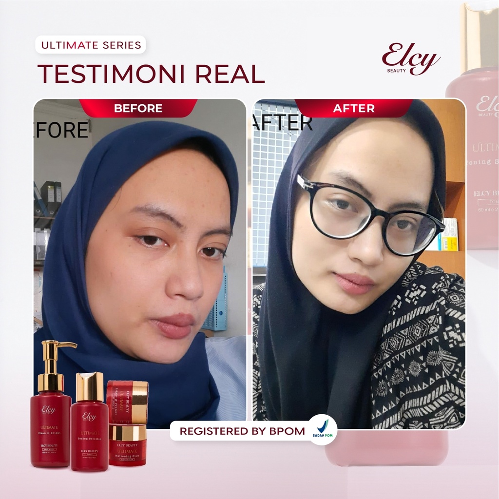 [BPOM] ELCY BEAUTY TERBARU ULTIMATE LC BEAUTY KF SKIN Paket/Ecer Krim Siang /Cream Malam /Toner Cleanser/ Sabun Facial Wash Serum LCBeauty/Klinik/Clinic