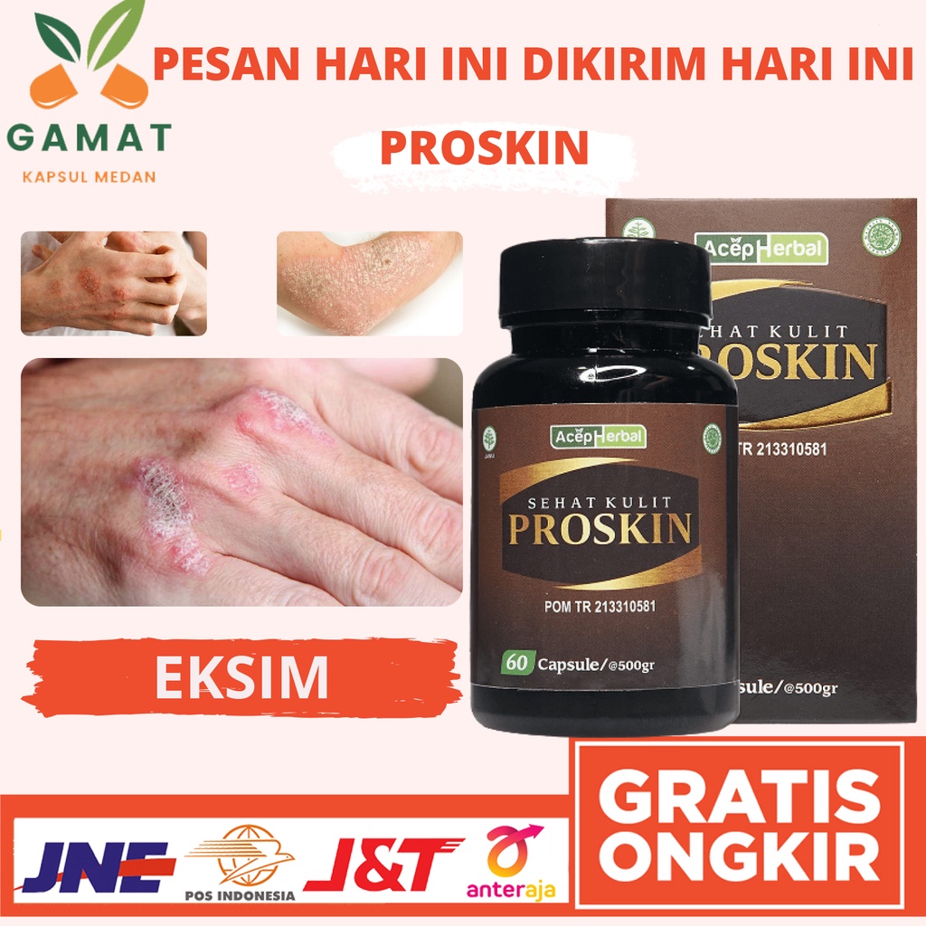 Obat Alami Eksim Panu Kurap Koreng Kudis Kadas Jamur di Selangkangan Gatal di Badan Psoriasis Budug 