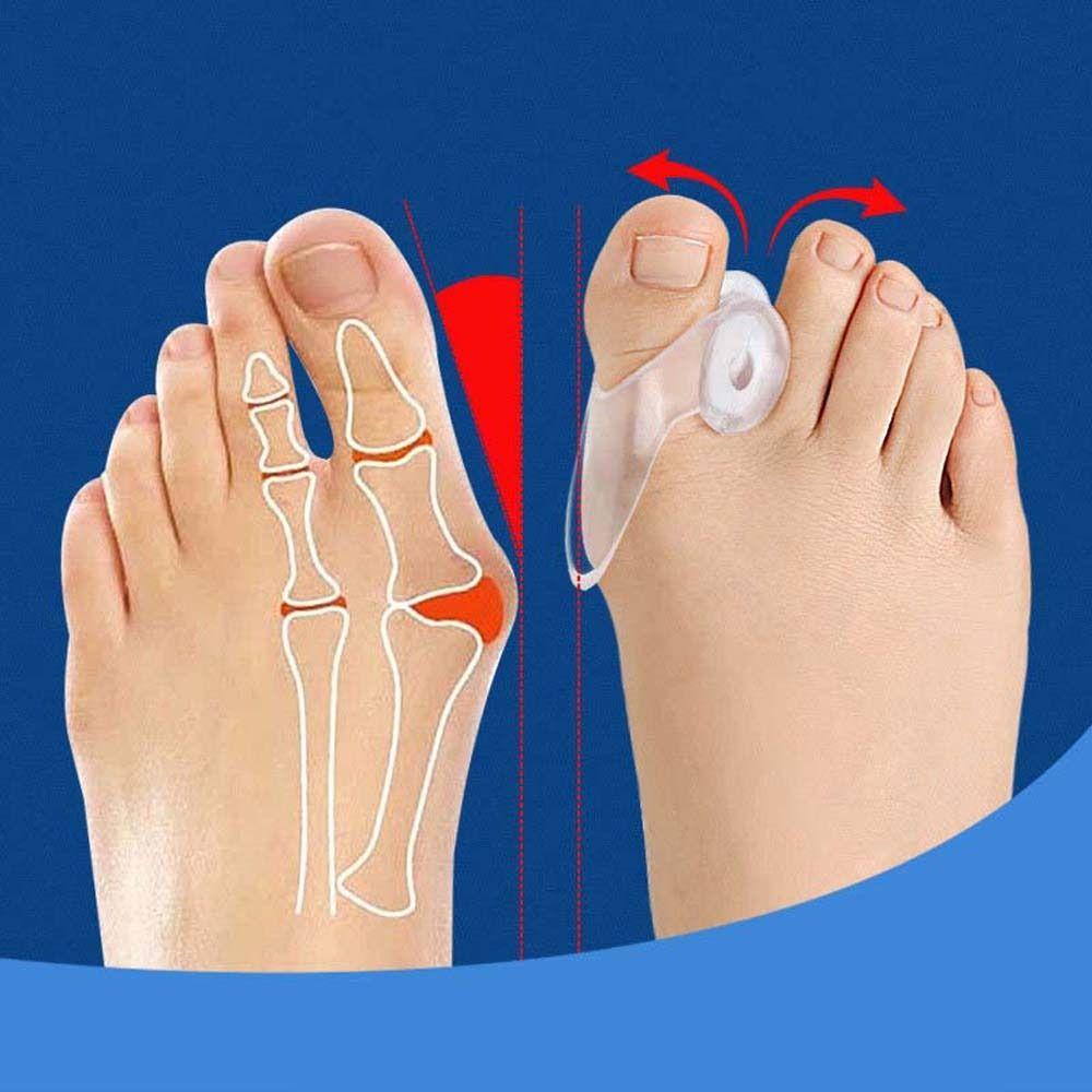 Mxbeauty Korektor Pelurus Jari Kaki Toe Cedera Toe Care Tools Foot Valgus Corrector Koreksi Jempol Bunion Protector Toe Brace Splint