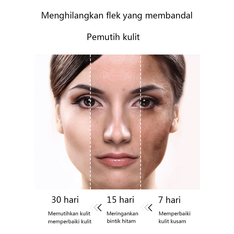 Pemutih wajah Serum pemutih wajah Night whitening salep flek hitam Penghilang flek hitam Salep Flek Hitam Melasma 100ML Secara efektif mengatasi flek hitam dan kulit hitam/Memutihkan kulit，memperbaiki kulit