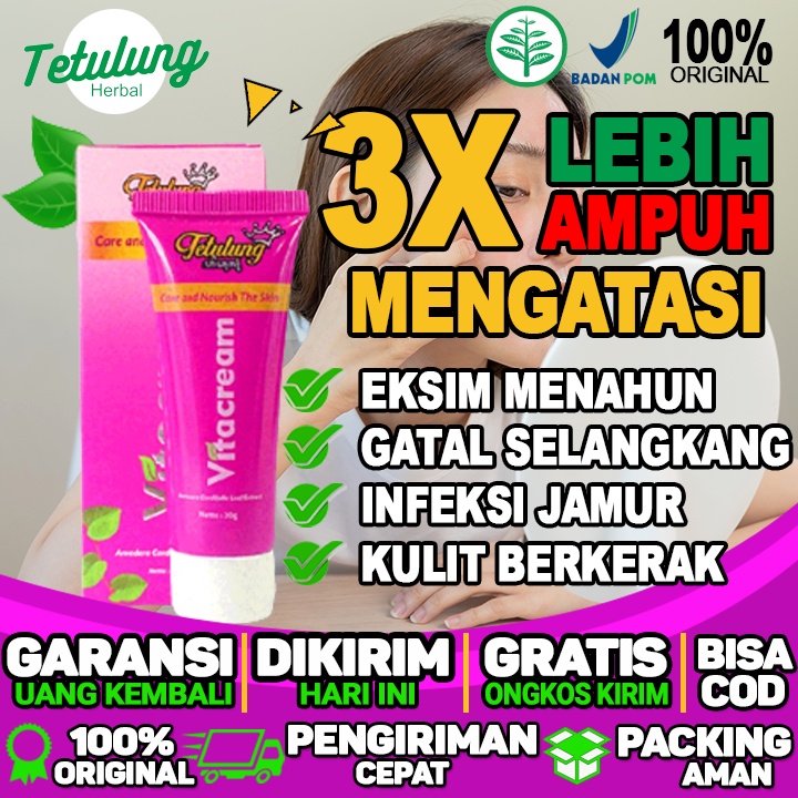 OBAT  SALEP GATAL EKSIM TRADISIONAL OBAT GATAL EKSIM DI SELANGKANGAN OBAT GATAL KARENA EKSIM