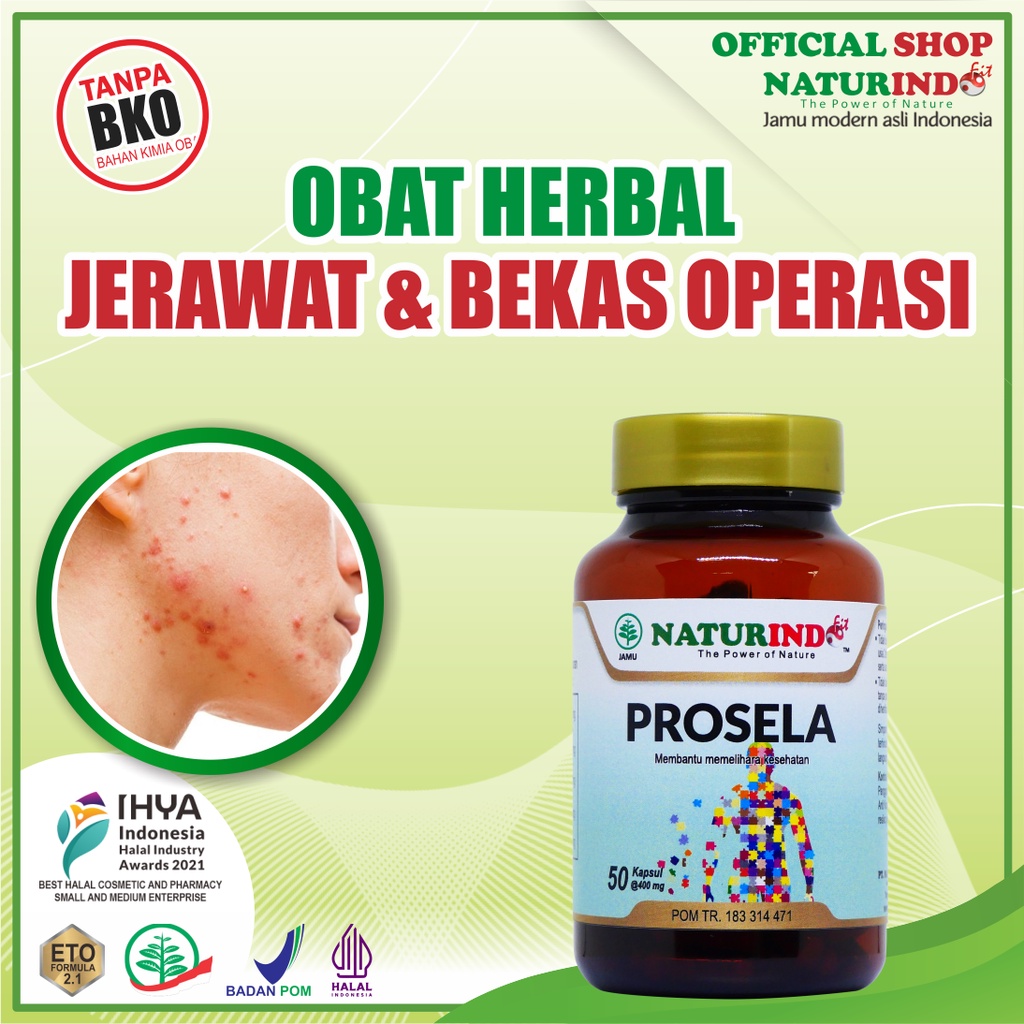 OBAT JERAWAT PROSELA SOYA NATURINDO