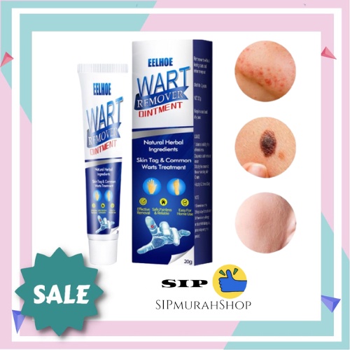 Krim Penghilang Kutil Sumifun Wart Remover, Tahi Lalat, Mata Ikan