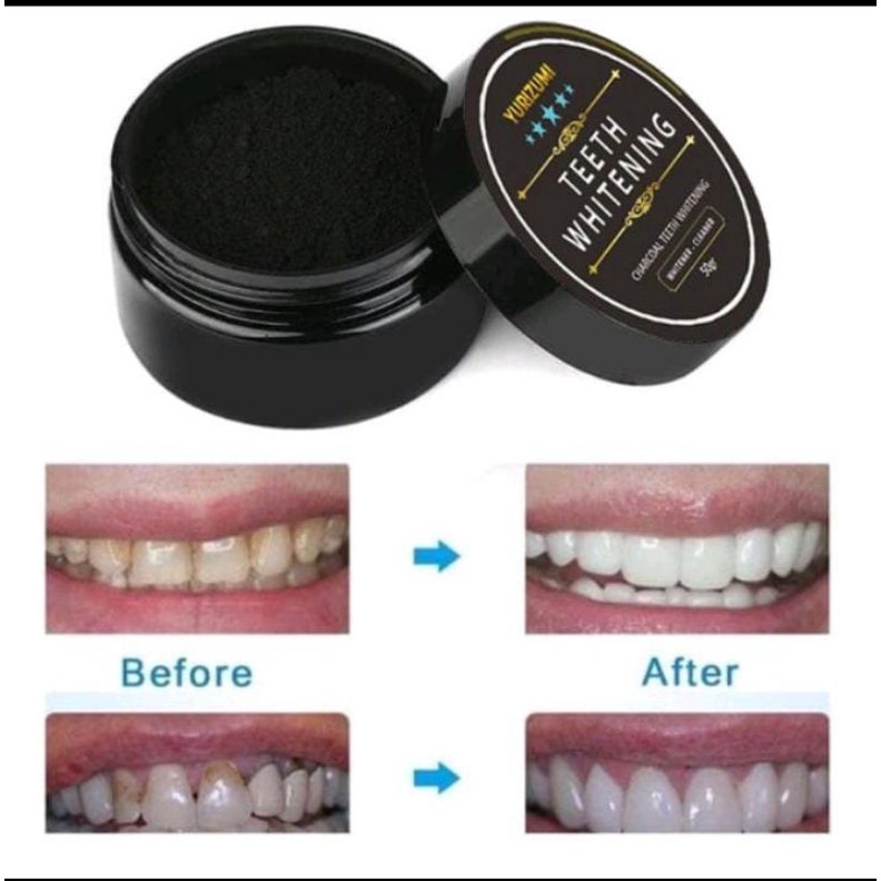 Teeth Whitening Charcoal Ori Activated Pemutih Gigi Kuning Alami Instant Permanen 50gr