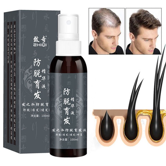 Serum Penumbuh Rambut Botak Serum Rambut Rontok Untuk Pria / Wanita - Hair Growth Serum Spray 100ML