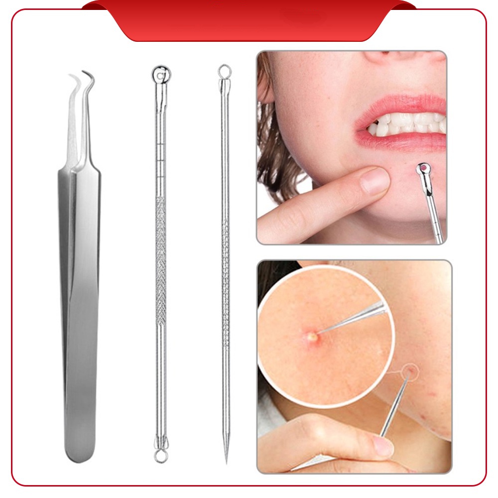 Alat Pinset Pencet Komedo Pembersih Jerawat Acne Blackhead 3 in 1