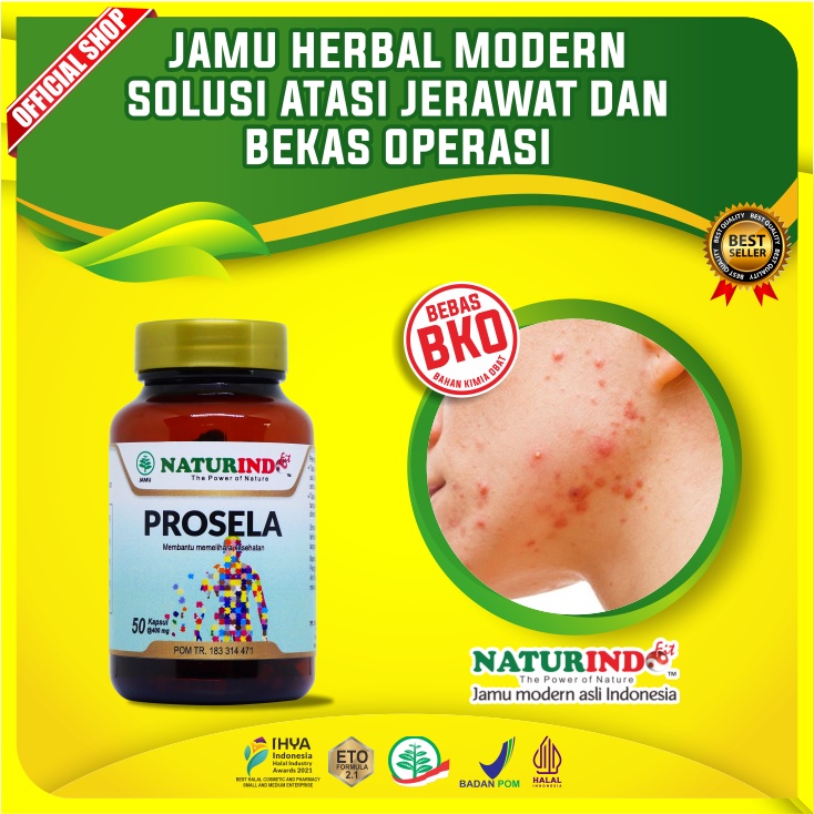 Obat Jerawat PROSELA SOYA Naturindo