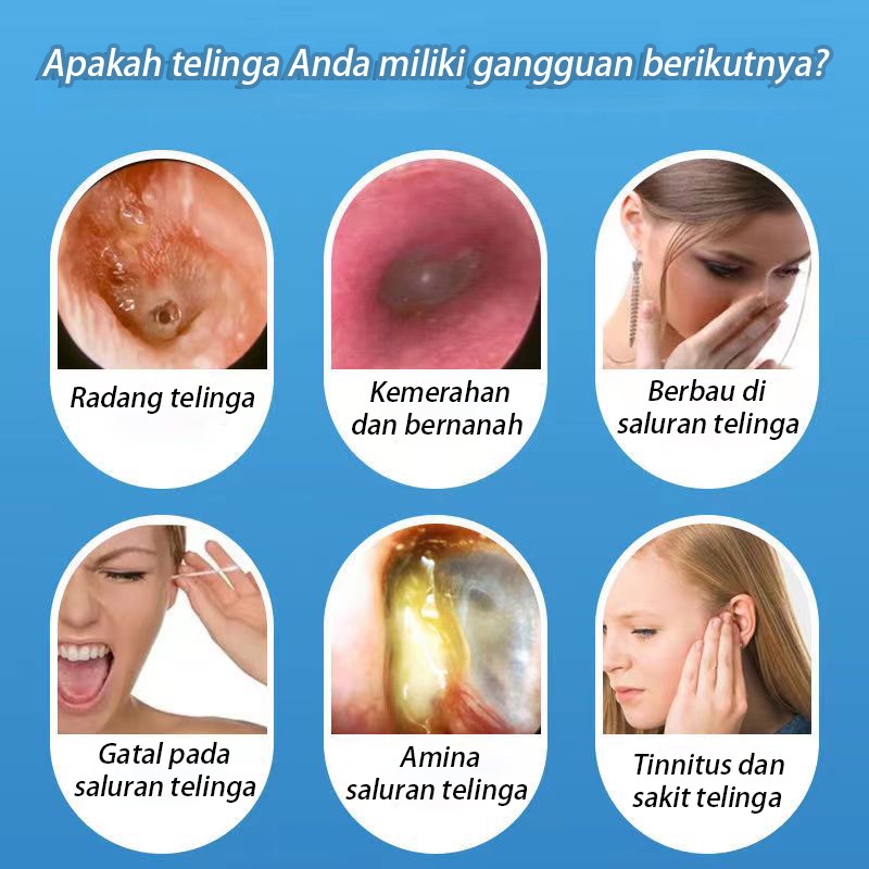 Obat Telinga Bernanah,Obat Telinga Sakit,Obat Tetes Telinga Bernanah, Obat Tetes Telinga Berair, Sakit Telinga, Kuping Sakit, Infeksi Telinga, Telinga Gatal 20ML 100% Asli 【COD】【BPOM】