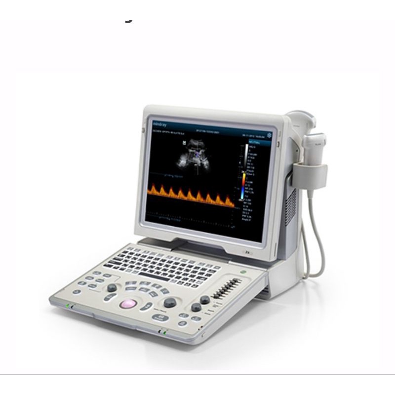 USG 4d mindray z8 Second