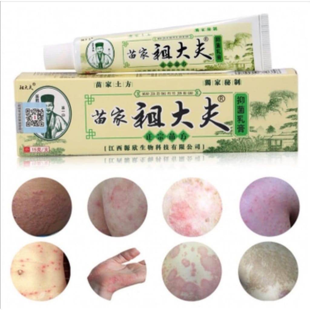 ORIGINAL 100% SALEP ZUDAIFU 15gr - ZU DAI FU HIJAU ASLI 100 % - Psoriasis Eksim Cream Jamur Kurap Alergi Kulit Chy Gao