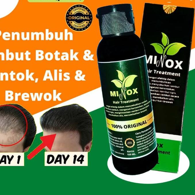 ✽ [MINOX] Penumbuh Rambut Botak, Tipis dan Rontok & Brewok Sangat Cepat dan Ampuh isi 100 ML ✵