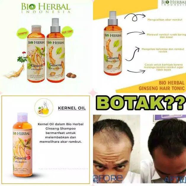 Penumbuh Rambut Botak dan Rontok Cepat Paling Ampuh untuk Pria dan Wanita Paket Shampo + Tonic Obat Rontok Bio Herbal Ginseng Asli Original