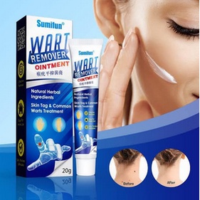 Sumifun Wart Remover Cream Penghilang Tahi Lalat & Kutil Original
