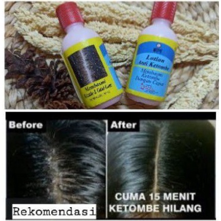 (BPOM) NOVE LOTION ANTI KETOMBE 50ML/ OBAT KETOMBE/ SUDAH BPOM