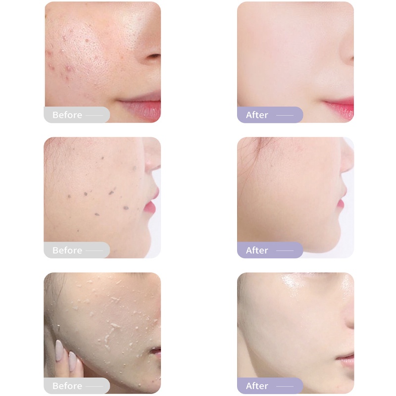 RtopR Mango Exfoliating Gel 40Gr -Face Scrub Eksfoliasi Wajah Untuk Pemutih Pelembab Exfoliasi Komedo Pembersih Jerawat Perawatan Wajah