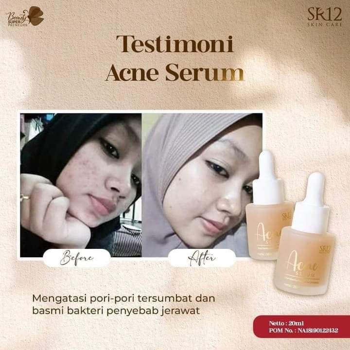 Acne Serum SR12 Serum Jerawat BPOM Ampuh Melawan Bakteri Penyebab Jerawat dan Mengecilkan Pori-pori