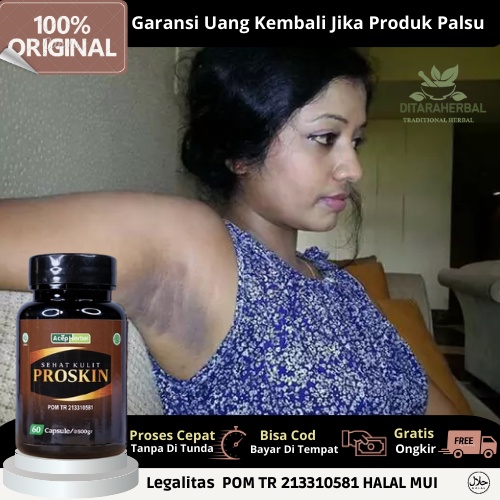 Obat Ketiak Hitam, Obat Penghilang Ketiak Hitam, Obat Ketiak Terasa Gatal Gatal, Obat Ketiak Berjamu