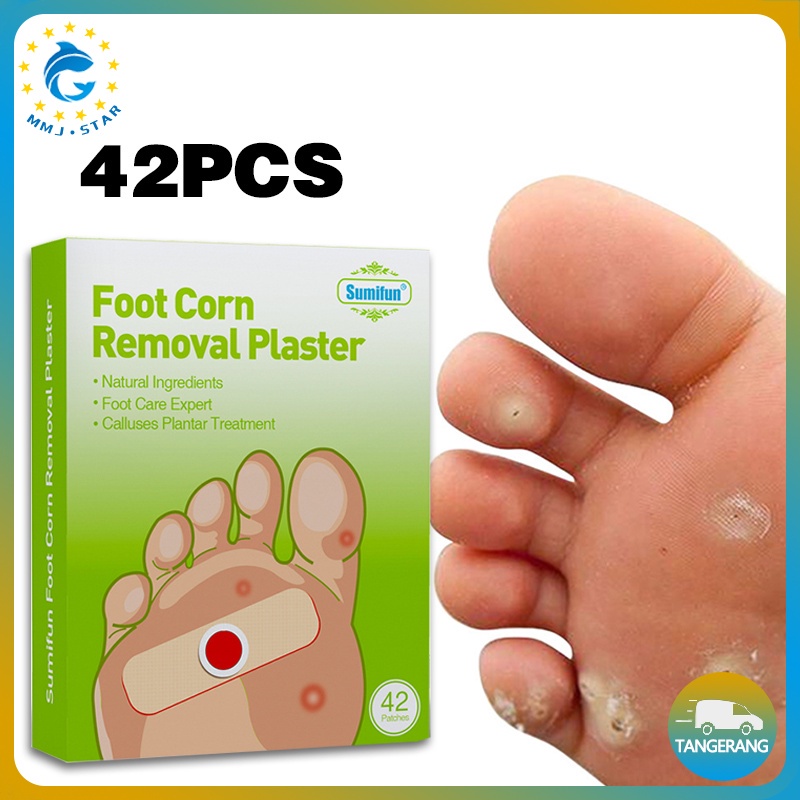 Patch Foot Corn Removal/Ji Yan Gao/Plester Mata Ikan/Patch Penghilang Mata Ikan