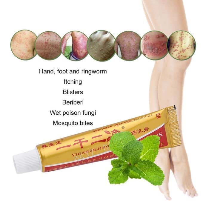 COD Yiganerjing Salep Obat Eksim Gatel Gatal - Kulit Jamur Herbal Dermatitis Psoriasis Eksim