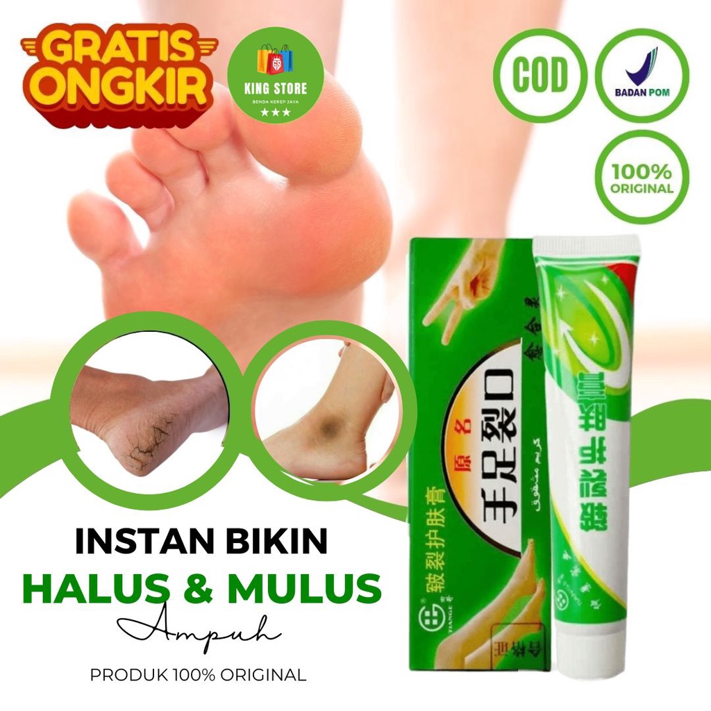 Obat Kaki Rayapan Ampuh Krim Kaki Pecah Dan Kering Obat Kaki Rayapan Dan Bau - Salep Kapalan Tangan 