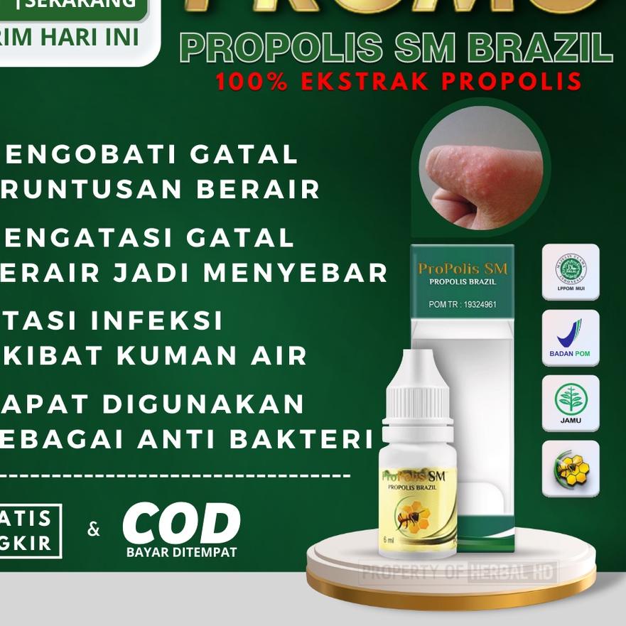 Flash Sale - Obat Herbal Gatal Berair, Salep Gatal Berair, Obat Gatal Berair Di Jari Tangan & Kaki, 