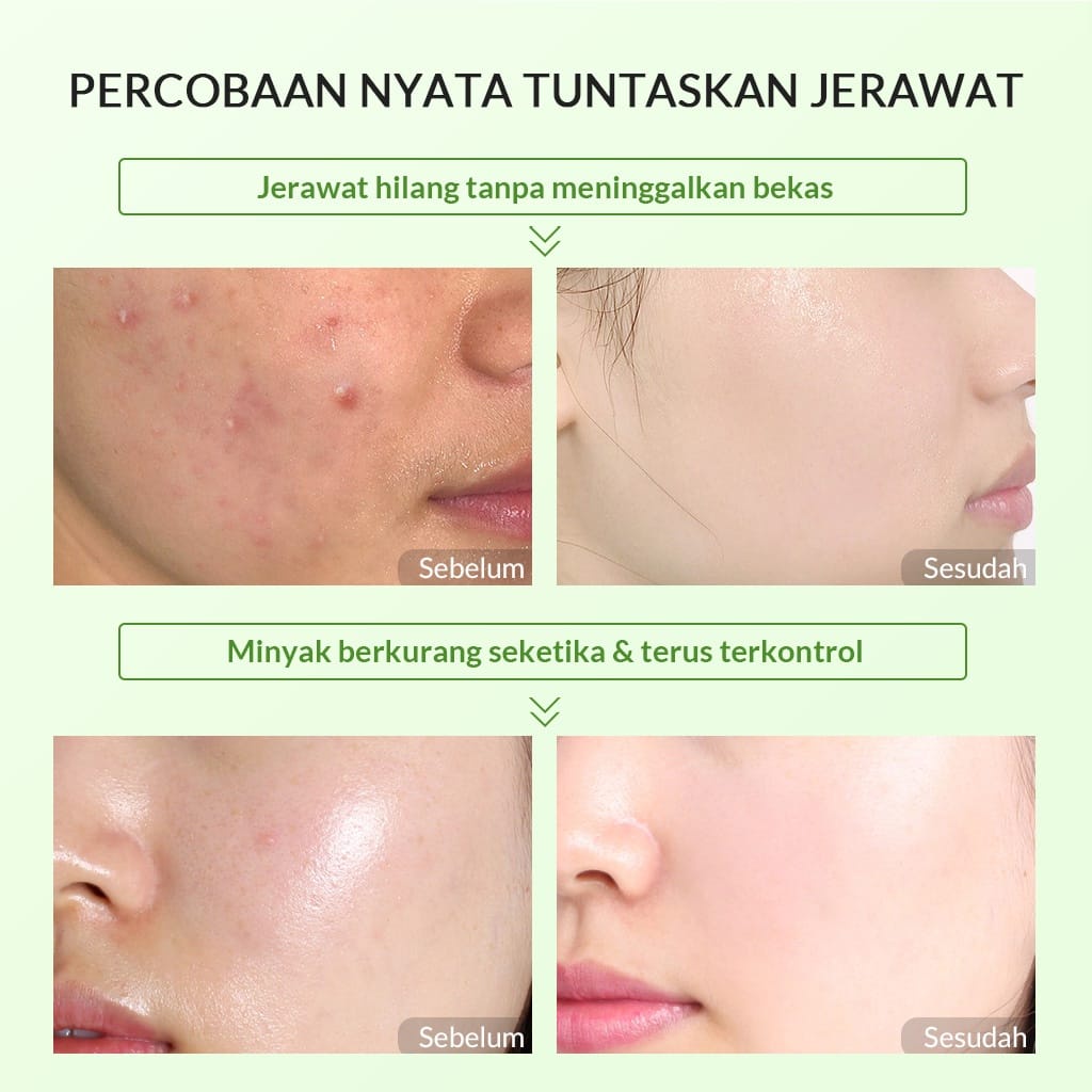 [PROMO+Masker Bioaqua] BIOAQUA Skincare Remaja | Paket Niacinamide Glowing &amp; Brightening | Tea Tree Oligopeptide Acne Set