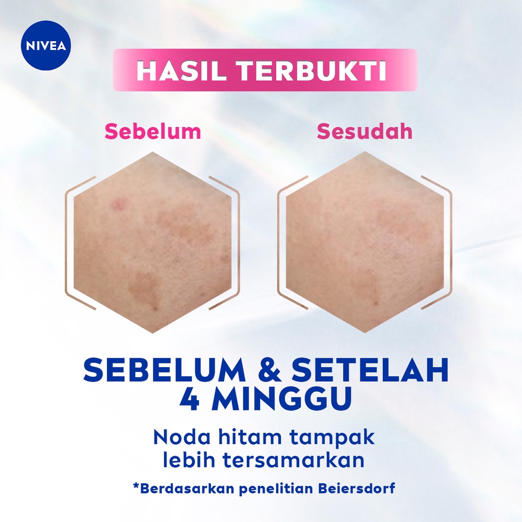 ★ BB ★  NIVEA Luminous 630 Spotclear SERIES | Spot Clear Intensive Treatment Serum 30ml - Spot Clear Sun Protect SPF50 40ml | Set Perawatan Flek Hitam