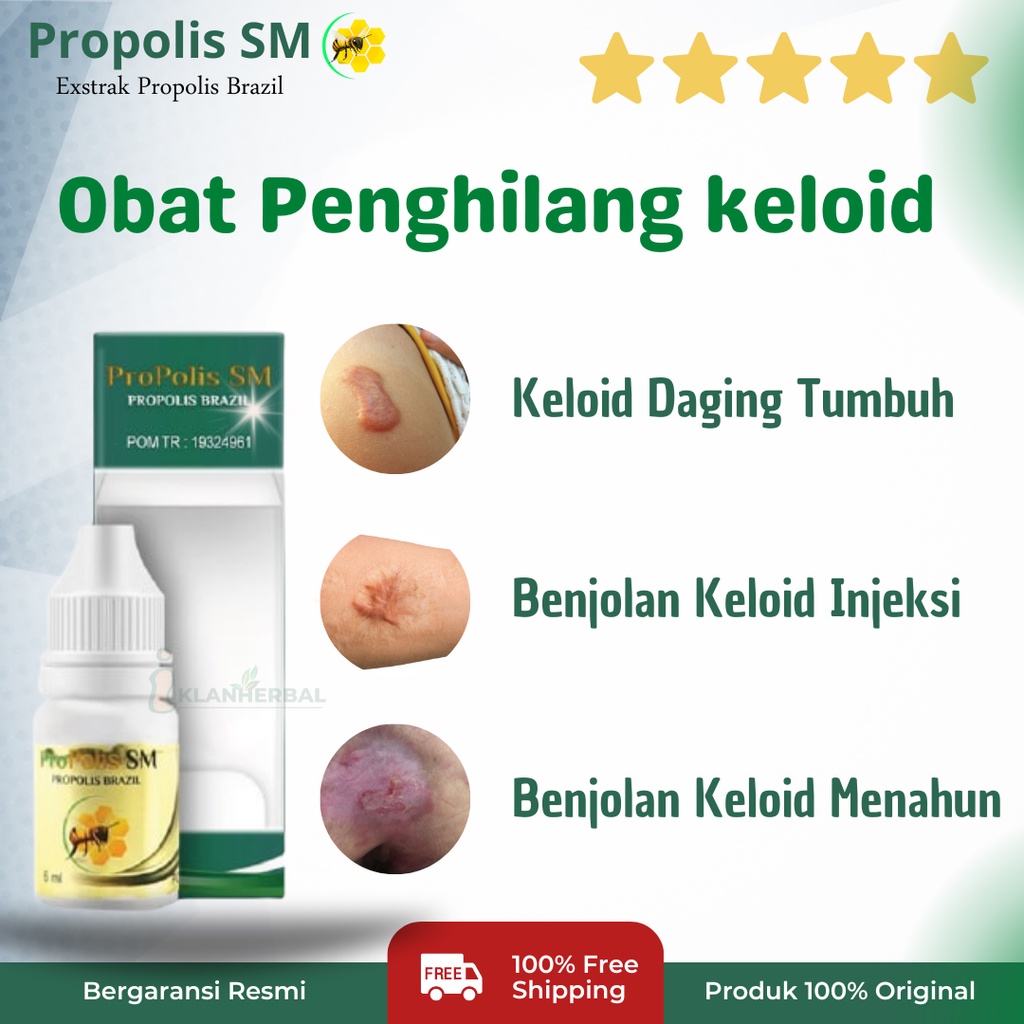 Jual Obat Keloid, Obat Penghilang Keloid, Obat Keloid Benjolan, Obat