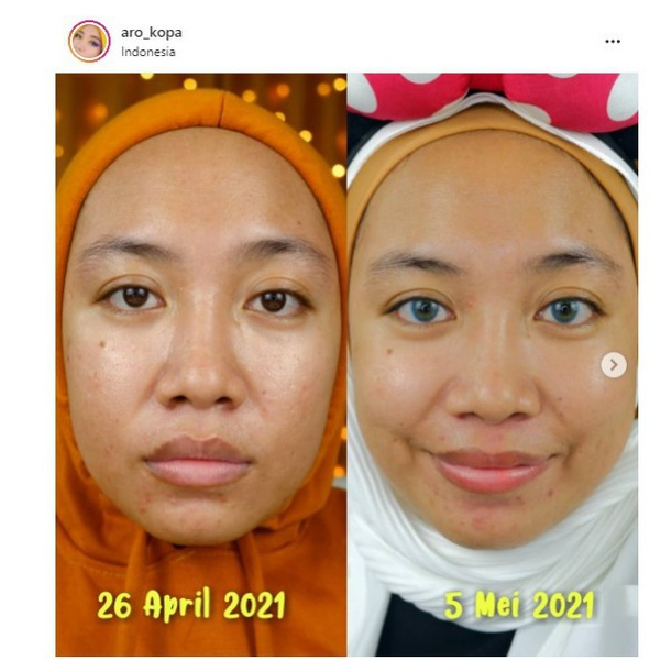 Retinol Renewal Serum 10ml &amp; 30ml - Pratista indonesia