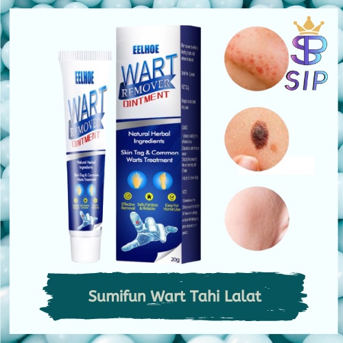 SKIN TAG REMOVER Menghilangkan Kutil Tahi Lalat Mata Ikan / SUMIFUN Wart Remover Ointment