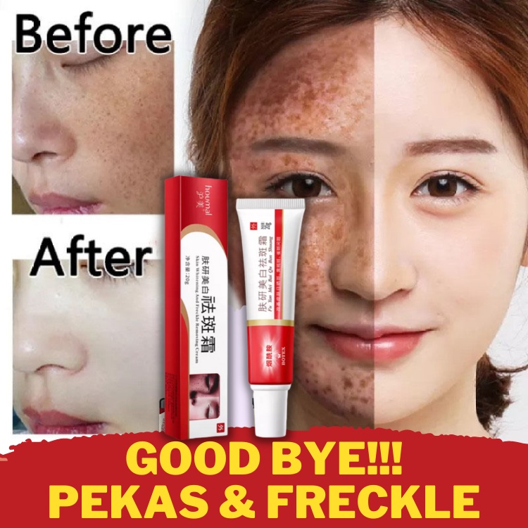 BEOTUA Whitening Freckle Cream Dark Spot Melasm Cream 20Gr Untuk Krim Pelembab Wajah Pemutih Penghilang Flek Hitam Bintik Hitam Perawatan Jerawat