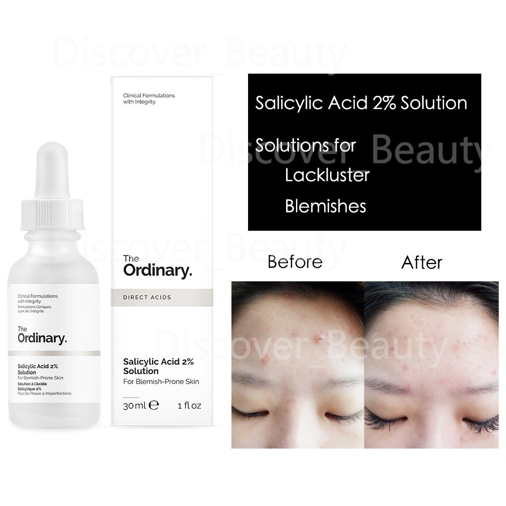 The Ordinary Salicylic Acid 2% Solution 30ml