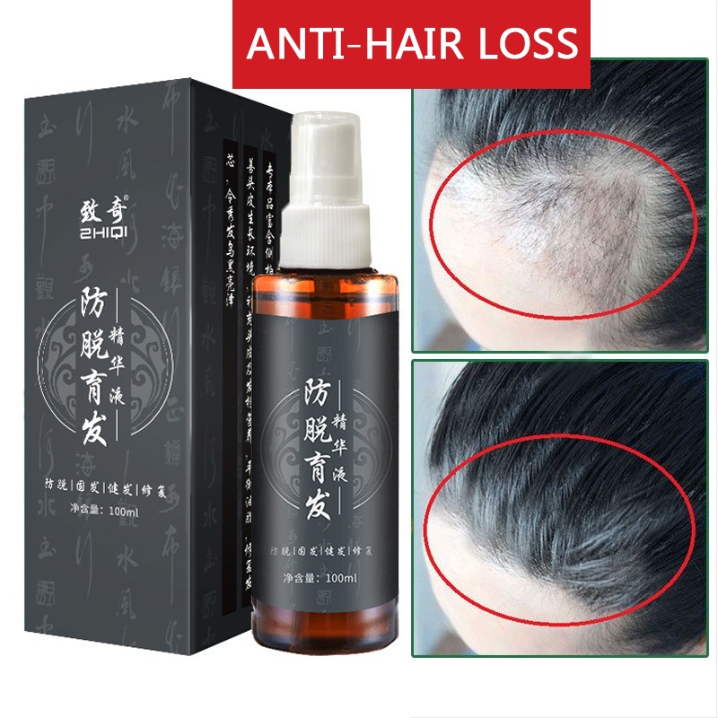 100ml Hair Growth Serum Spray- Obat Penumbuh Rambut Rontok Penumbuh Rambut Botak Hair Growth Serum Spray Serum Penumbuh Rambut