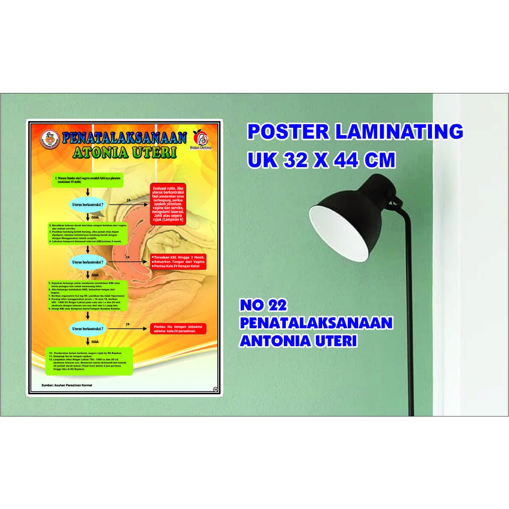 POSTER KESEHATAN NO 22 PENATALAKSANAAN ANTONIA UTERI LAMINATING