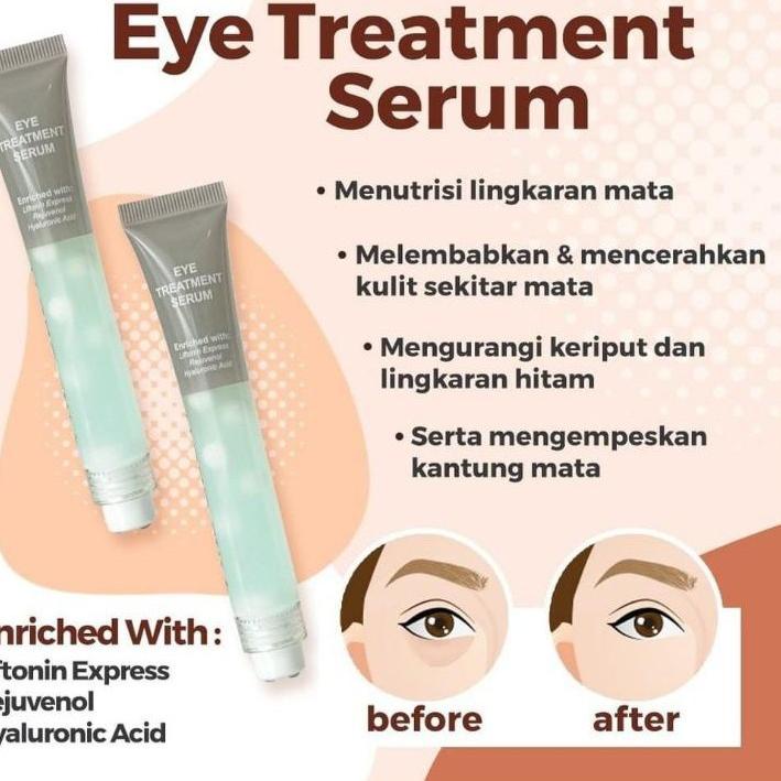 ✪ EYE CREAM MS GLOW ORI EYE DARK CIRCLE CREAM - CREAM MATA eye treatment ms glow ✹