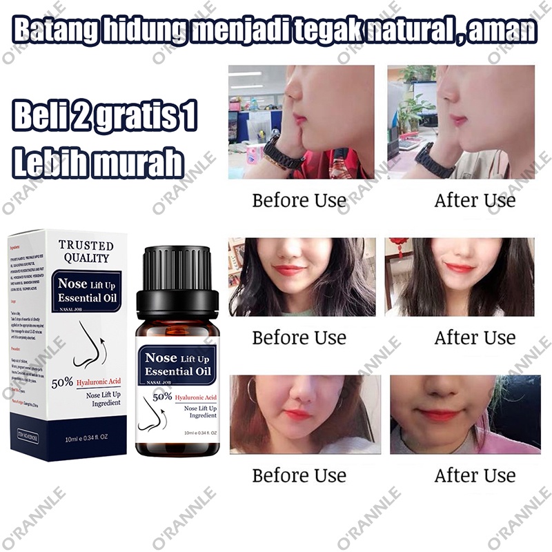 【100% ORIGINAL】cairan peninggi batang hidung Alat hidung pemancung hidung alat pemancung hidung 10ml Nose lift up essential oil Hidung Cepat Memancungkan hidung menjadi mancung