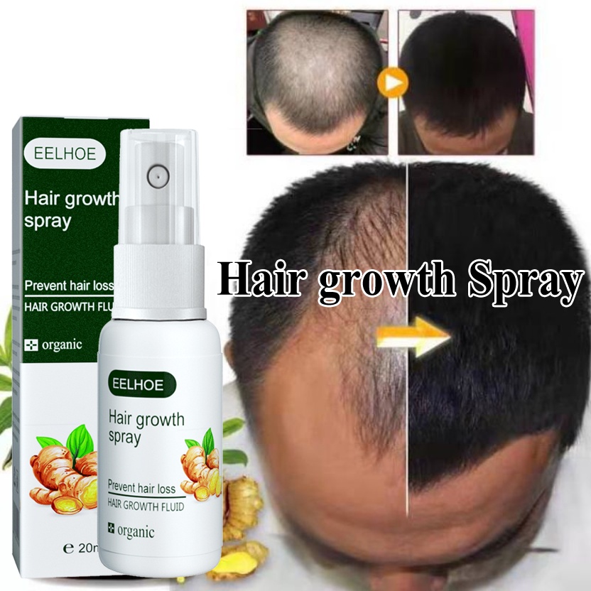 【ORIGINAL】penumbuh rambut Hair growth serum penumbuh rambut botak serum penumbuh rambut 20ml serum rambut rontok Penumbuh Rambut Cepat Anti Rontok Mengatasi Botak Pencegah Rambut Rontok Perawatan Kulit Kepala Minyak Pertumbuhan Cepat