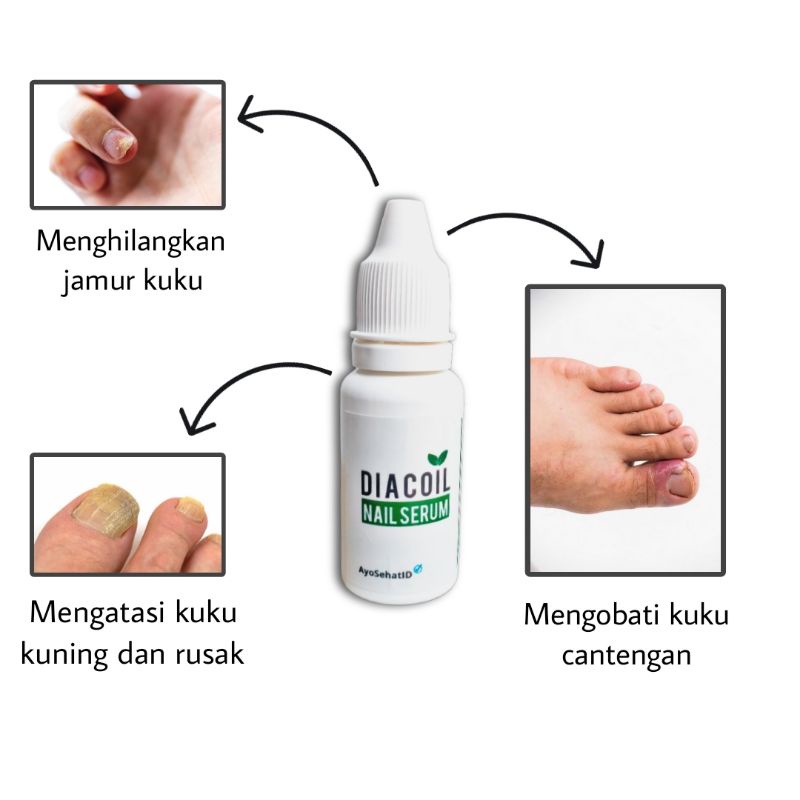 DIACOIL NAIL SERUM OBAT TETES KUKU CANTENGAN DAN JAMUR KUKU