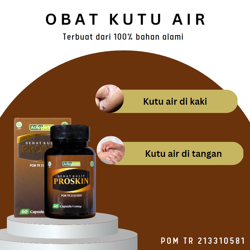 Kaka Herbal - Obat Kutu Air, Obat Gatal Di Sela Sela Jari Kaki Dan Tangan, Jamur Kaki, Kutu Air Pada