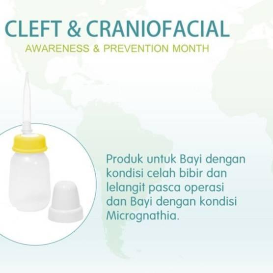 ✬ Botol Bibir Sumbing Pigeon Botol Pipet Bibir Sumbing Pigeon dot panjang bayi ➵