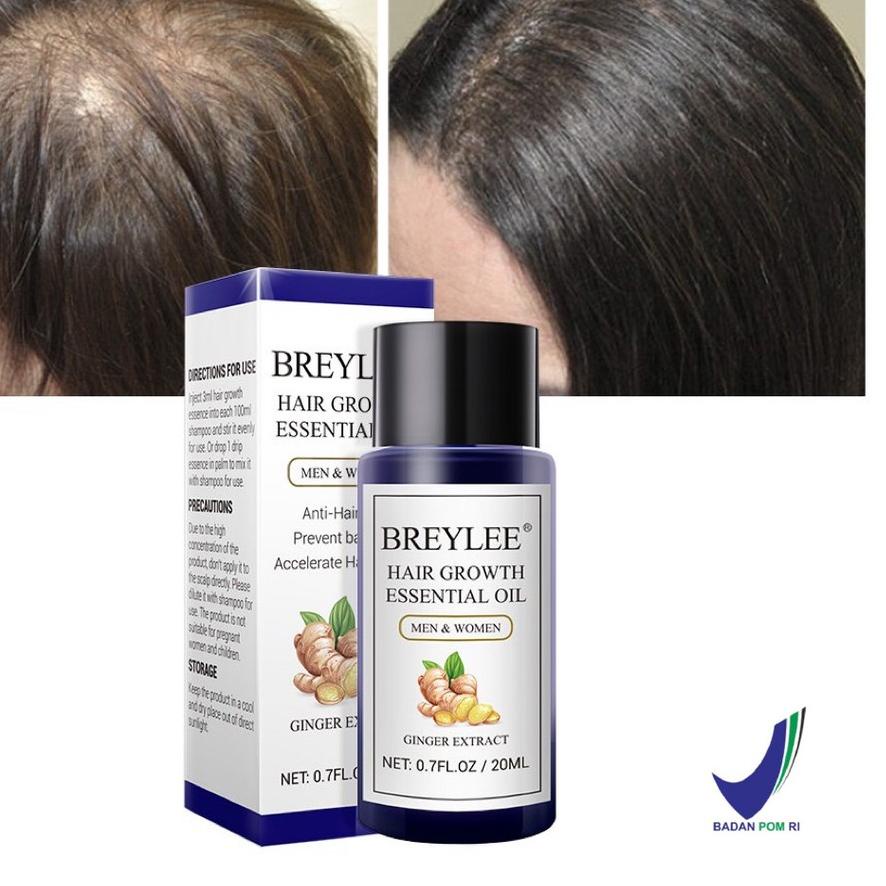 ➮ [] BREYLEE Hair Growth Essential Oil 20ml (Serum Penumbuh Rambut - Mencegah Kerontokan) ♢
