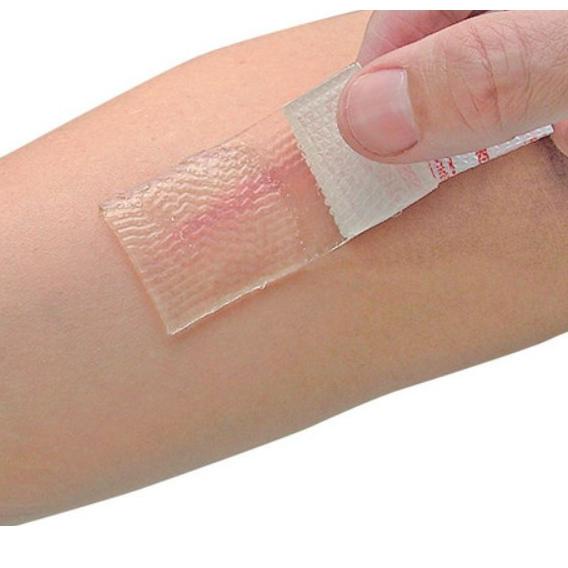 ☻ Cica-Care Silicone Gel untuk Keloid ✵