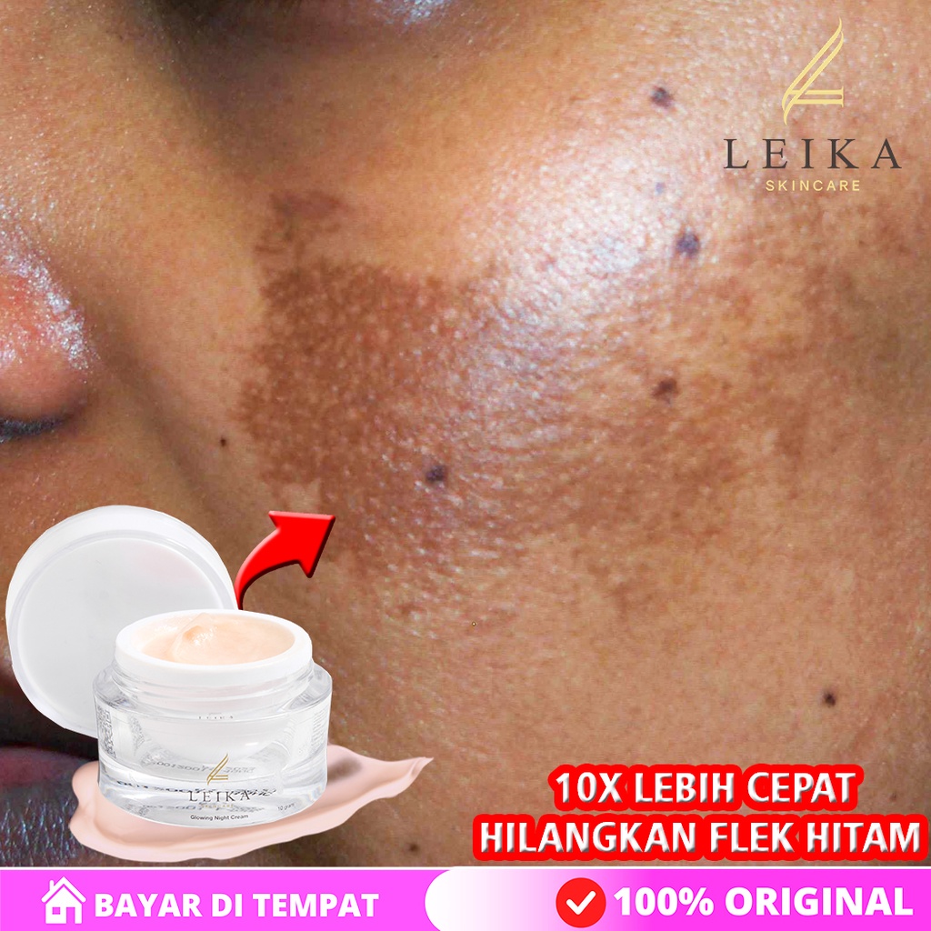 AMPUH  FLEK HITAM HILANG PERMANEN Obat penghilang flek hitam membandel BPOM Krim penghilang flek hit