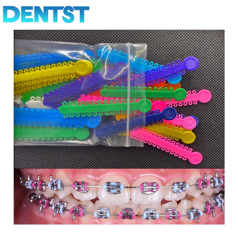 1 PCS Karet Behel Ortho Power O Ikatan Ligatur Elastomer Gigi Ortodontik Karet Elastik Kawat Gigi untuk Braket Ortodoncia