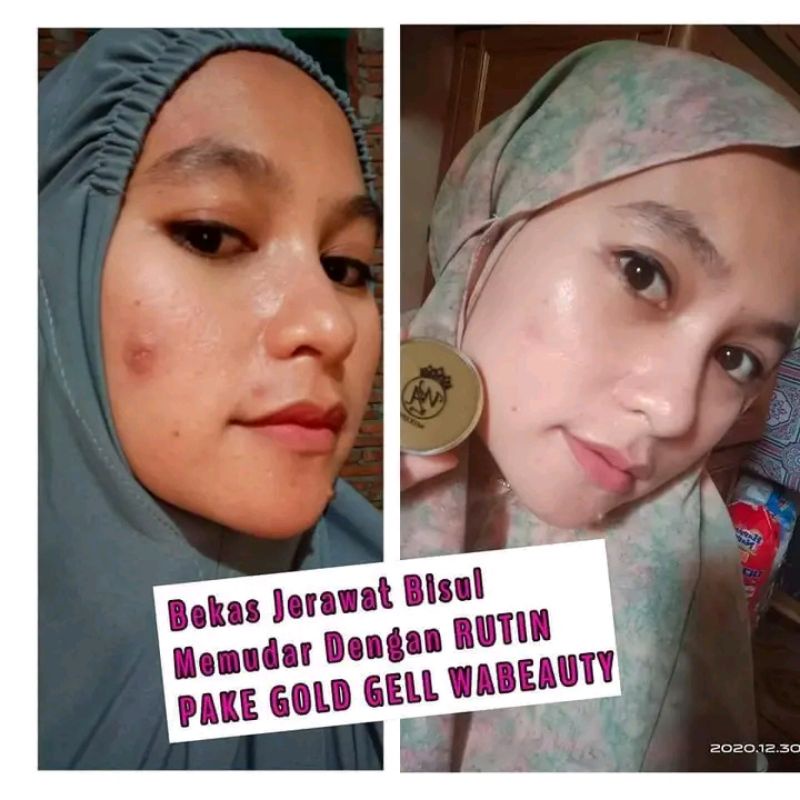 Gold Gel WASILA COSMETIK ORI