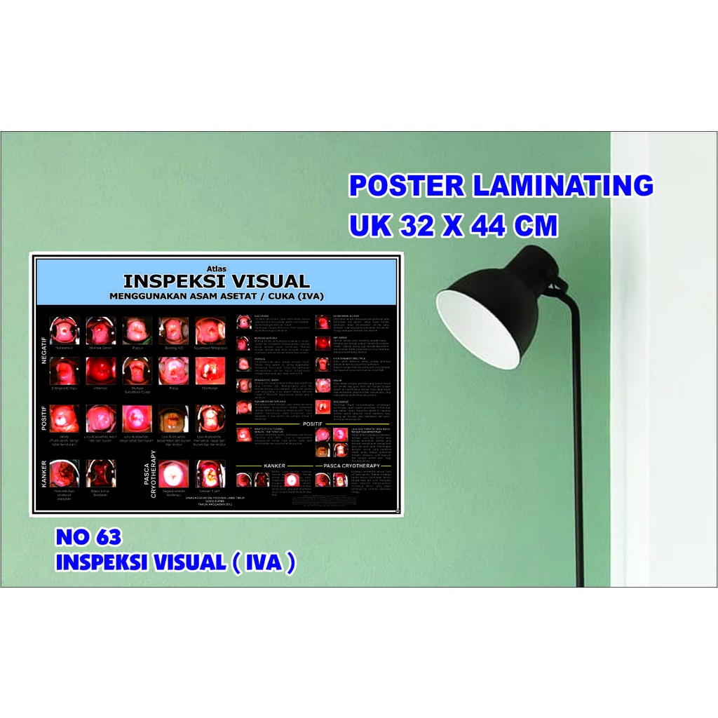 POSTER KESEHATAN NO 63 INSPEKSI VISUAL ( IVA) LAMINATING