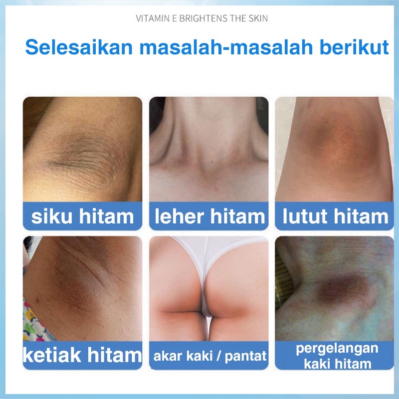 krim ketiak krim pemutih memutihkan melembabkan menghilangkan melanin lengan paha lutut pemutih ketiak menghilangkan selangkangan
