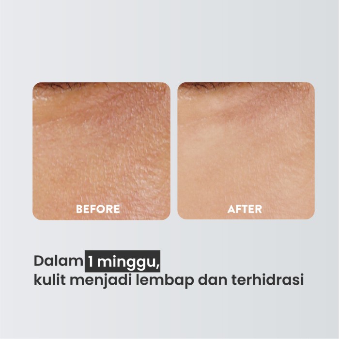 NPURE NONI PROBIOTICS &quot;COMFORT ME&quot; MOISTURIZER Moisturiser Pelembab Wajah