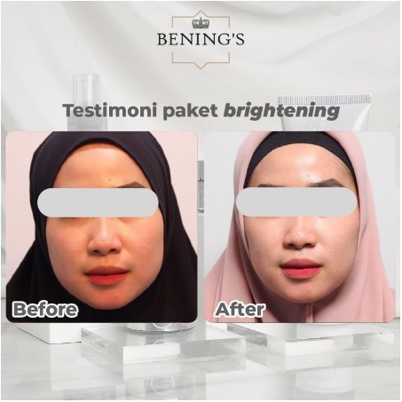 Benings Brightening Series | Bening Skincare Doctor Oky Pratama