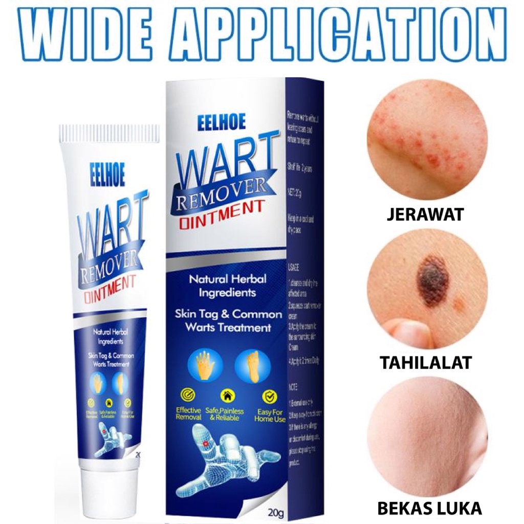 Sumifun Wart Cream Removal salep Penghilang Kutil Lalat Menghapus Mata Ikan dan Kutil callusol obat kutil Cream Skin Tag Remover 20g - calusol obat kutil Mata Ikan Penghilang Tahi Lalat Krim Penghilang Kutil Sumifun Wart Remover